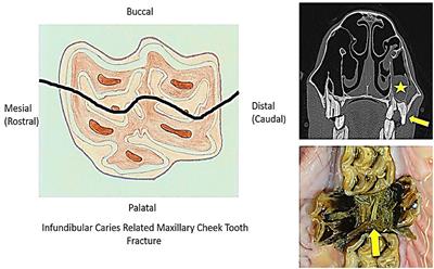 Equine “Idiopathic” and Infundibular Caries-Related Cheek Teeth Fractures: A Long-Term Study of 486 Fractured Teeth in 300 Horses